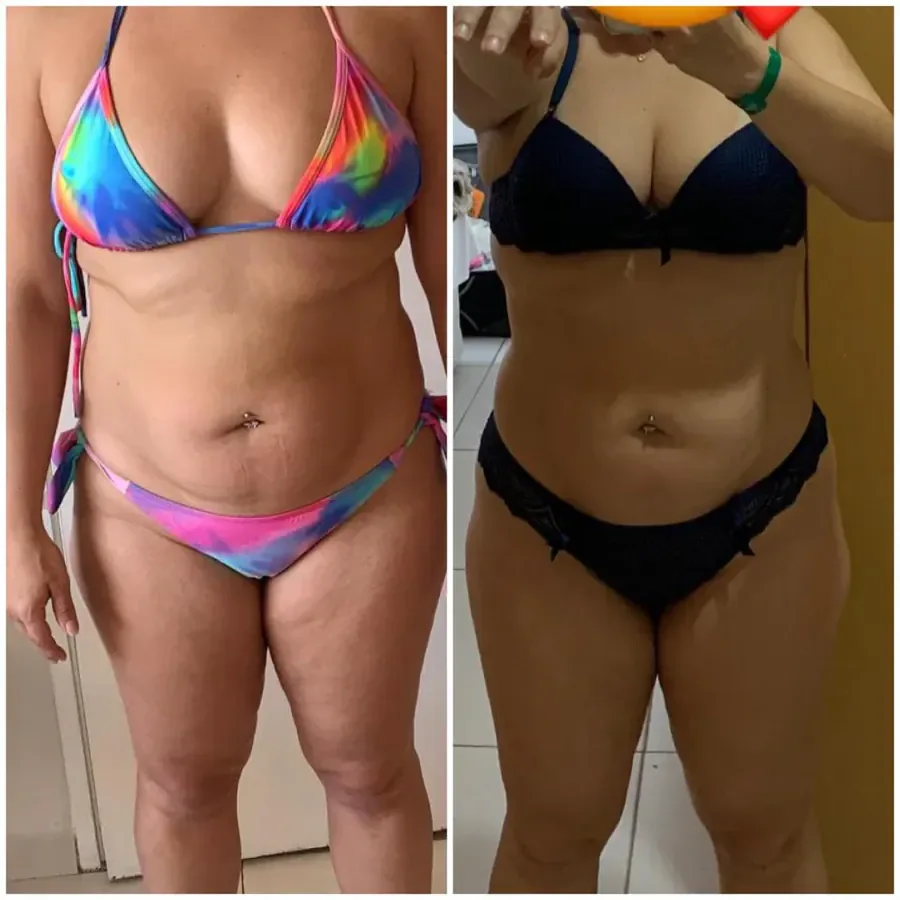 Antes e depois de Natália com o Método Ativa & Afina.